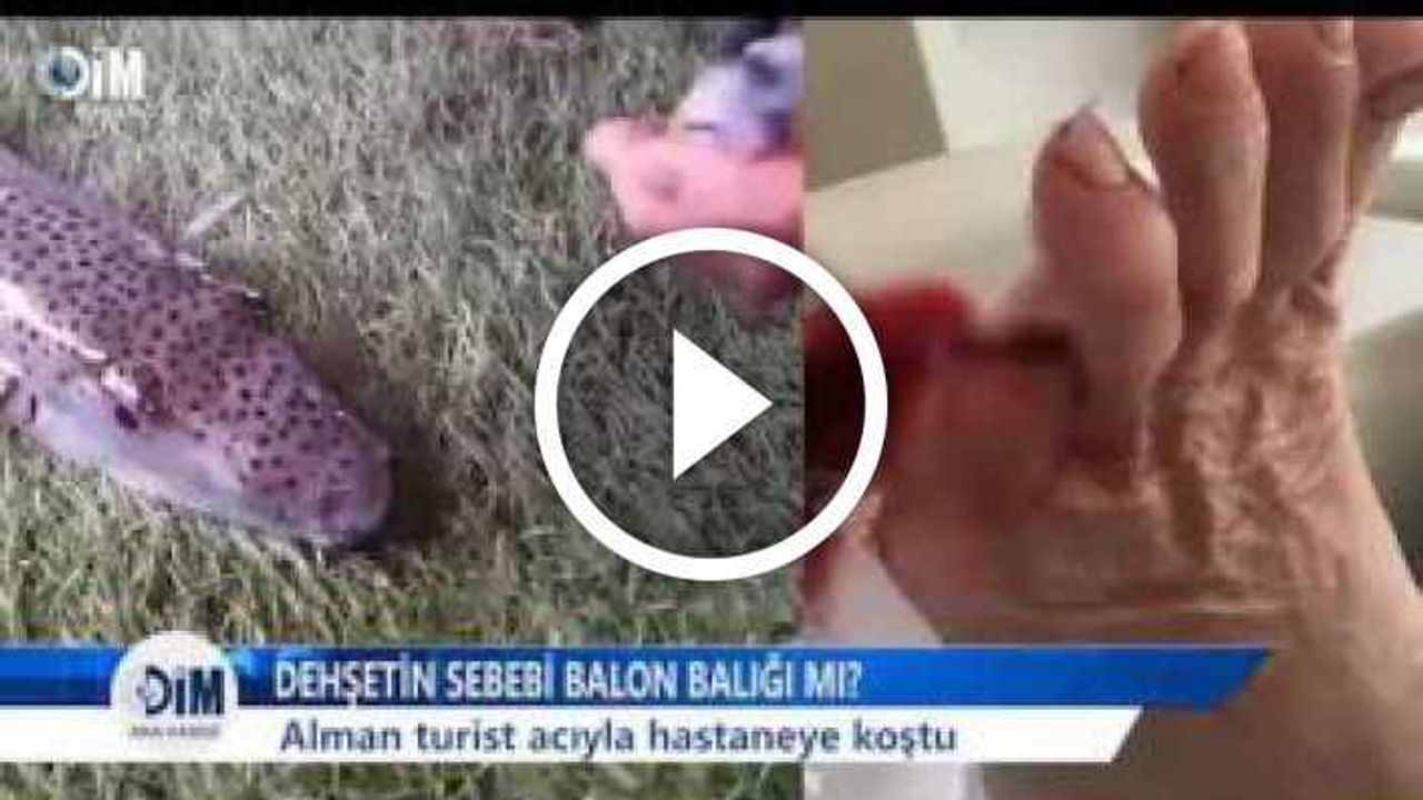 Alanya’da balon balığı dehşeti! Alman turist acıyla hastaneye koştu