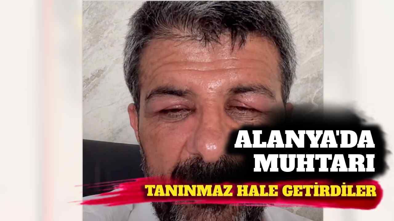Alanya'da muhtarı tanınmaz hale getirdiler