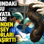 15 yaşındaki çocuğun midesinden çıkanlar hayret ettirdi