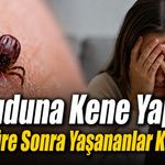 Vücuduna kene yapışan kadın hayatını kaybetti