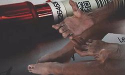 Korkunç hastalık 30 yıl sonra geri döndü: Avrupa panikte