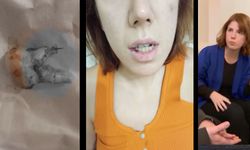 Diş ağrısı kabusa döndü: İki yıldır sadece mama yiyor