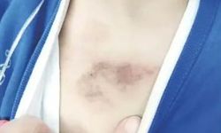 3 yaşındaki çocuğa şiddet ve istismar iddiası: Bakanlık çalışma başlattı