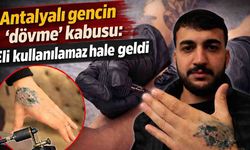 Antalyalı gencin 'dövme' kabusu: Eli kullanılamaz hale geldi