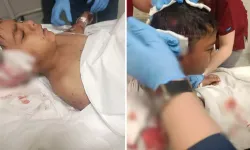 Küçük çocuğa başıboş köpek saldırısı: Okul çıkışı şoke eden olay!