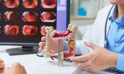 Kalın bağırsak kanserinde erken tanı hayat kurtarıyor