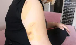 Dini nikahlı eşe korkunç pusu: Kadın canını zor kurtardı