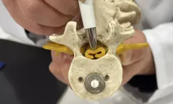 Bel fıtığıyla karıştırılıyor: Omurga daralması günlük hayatı sessizce kısıtlıyor