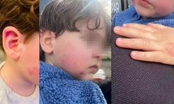 Kreşte 2,5 yaşındaki çocuk darp edildi: Kurumdan skandal savunma