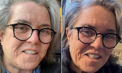 Feminizme ihanet dediği yüz germe ameliyatını yaptırdı