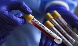 Ebola’nın nadir türüne karşı üç yeni aşı geliştiriliyor