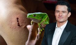 İngiltere'de kurbağa zehri detoksunda bir kişi öldü