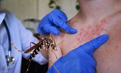 İklim değişikliği Chikungunya virüsü riskini artırıyor