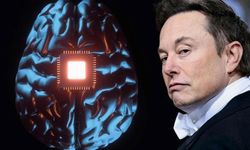 Türk doktorlardan Elon Musk'ın beyin çipi projesine uyarı