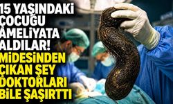 15 yaşındaki çocuğun  midesinden çıkanlar hayret ettirdi