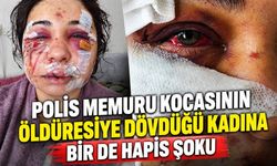 Polis memuru kocasının öldüresiye dövdüğü kadına bir de hapis şoku