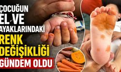 Çocuğun el ve ayaklarındaki renk değişikliği gündem oldu