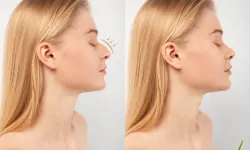 Burun estetiğinde sadece görünüm değil nefes de önemli