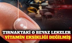Tırnaktaki beyaz lekeler her zaman vitamin eksikliği değil