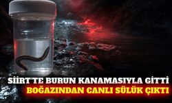Siirt'te burun kanaması olan çocuğun boğazından sülük çıktı