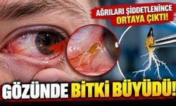Gözündeki ağrının nedeni doktorları şaşkına çevirdi: İçinden bitki çıktı!