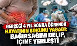 Ameliyattan Sonra Hayatının Şokunu Yaşadı!