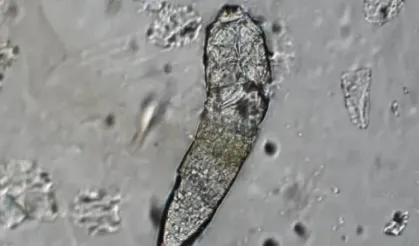 Hepsi cildimizde yaşıyor: Geceleri çiftleşip sabah kayboluyorlar