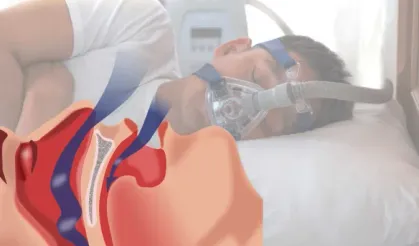 Bayram dönüş yolunda 'uyku apnesi' uyarısı