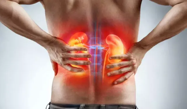 “Ağrım Geçti” demeyin: Böbrek taşı böbreği kaybettirebilir