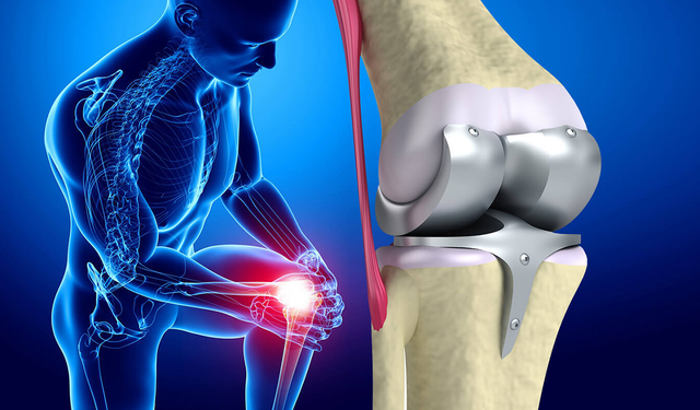 Kas-İskelet ağrılarına yeni yaklaşım: Proloterapi