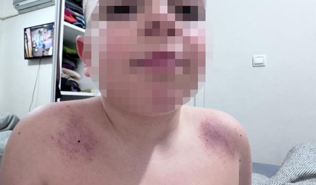 Antalya'da öğretmene darp ve tehdit iddiası: 8 yaşındaki öğrenci için şikayet