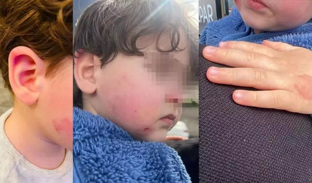 Kreşte 2,5 yaşındaki çocuk darp edildi: Kurumdan skandal savunma