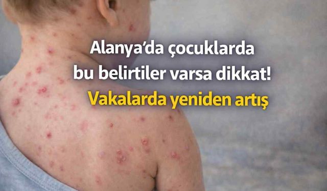 Alanya'da çocuklarda bu belirtiler varsa dikkat! Vakalarda yeniden artış