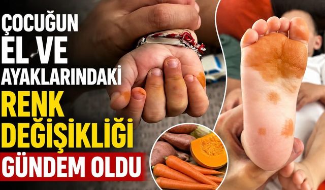 Çocuğun el ve ayaklarındaki renk değişikliği gündem oldu
