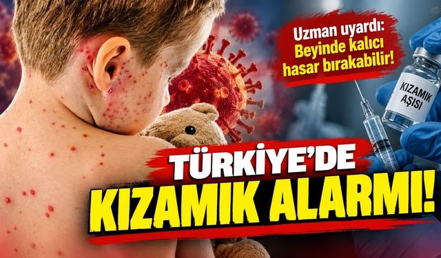 Türkiye’de kızamık alarmı! Uzman uyardı: Beyinde kalıcı hasara yol açabilir