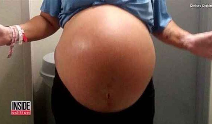 Doğum sonrası bebeğini görünce gözlerine inanamadı