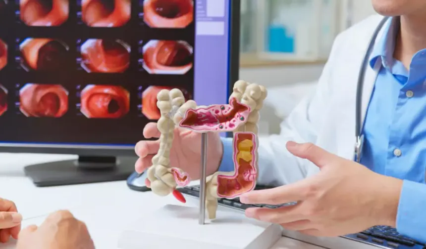 Kalın bağırsak kanserinde erken tanı hayat kurtarıyor