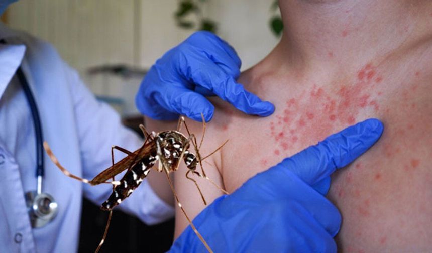 İklim değişikliği Chikungunya virüsü riskini artırıyor