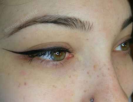 Son moda estetik çılgınlığı!