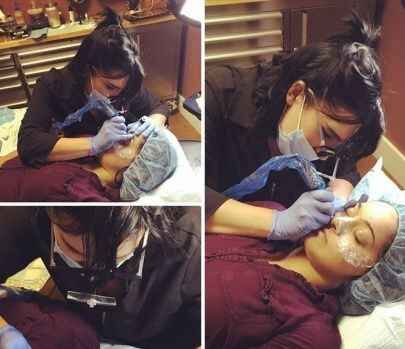 Son moda estetik çılgınlığı!