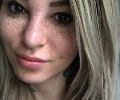 Son moda estetik çılgınlığı!