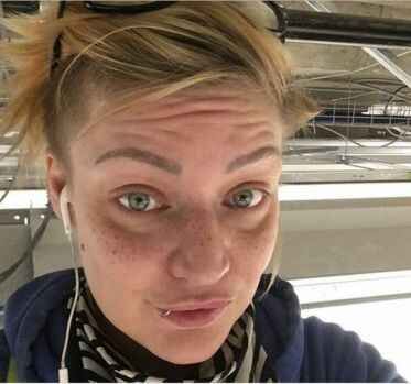 Son moda estetik çılgınlığı!