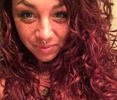 Son moda estetik çılgınlığı!