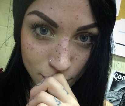 Son moda estetik çılgınlığı!