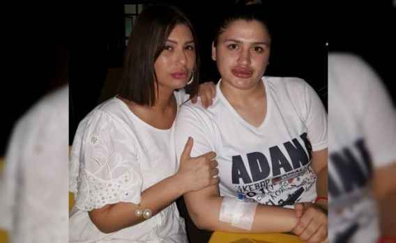 Estetik mağdurları hastanede buluştu