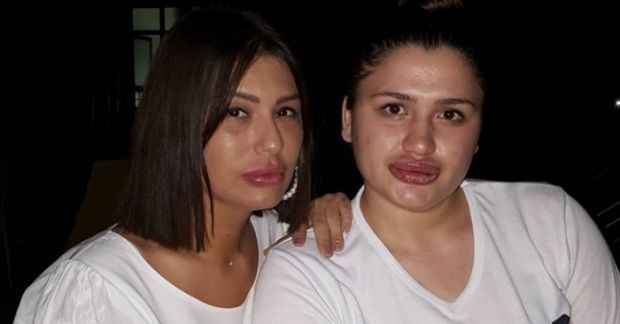 Estetik mağdurları hastanede buluştu