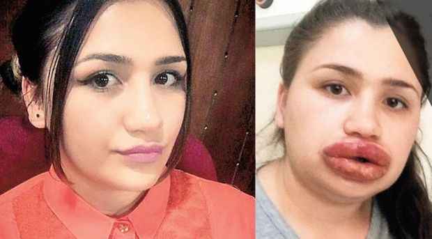 Estetik mağdurları hastanede buluştu